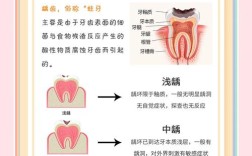 窝沟龋 治疗方法