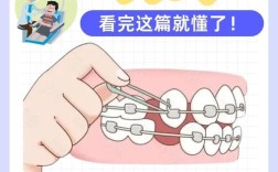 江西矫正牙齿要多少钱