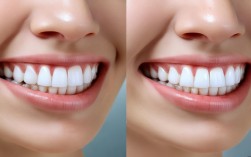 2025最新，矫正牙齿后几年会变形？现在还有这问题吗？