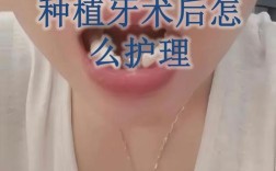 种牙第三天可以刷牙吗