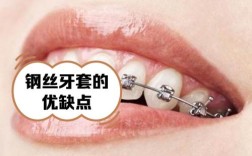牙科正畸钢丝种类有哪些？如何挑选适合自己的？