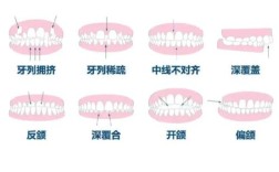 正畸面型分类图片