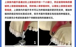 种牙提升什么意思