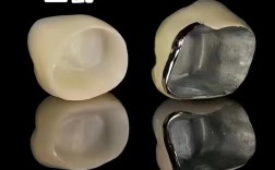 烤瓷冠试戴的正确方法有哪些？