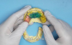 矫正牙齿前，具体需要做哪些准备工作？