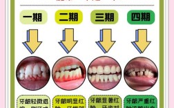 牙龈萎缩后刷牙的正确方法是什么？有哪些注意事项和技巧？