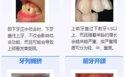 有乳牙能矫正牙齿吗