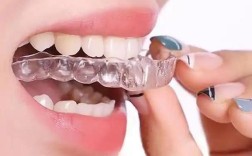 圣玛特正畸价格怎么样？值不值得做？