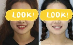 重庆牙齿矫正怎么选？效果、价格、服务，哪家靠谱？