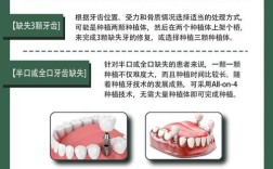 缺一颗牙需要种几颗