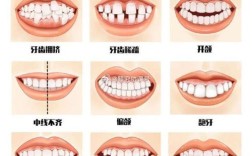 矫正牙齿之后可以正常吃东西吗？