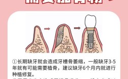 为什么种植牙时医生会建议使用骨粉？其背后的原因和必要性究竟是什么？