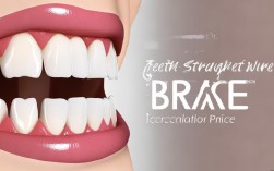2025年牙齿直线弓矫正价格多少？