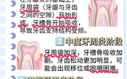 牙周炎适合植牙吗