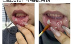 大人口腔疾病有哪些治疗方法？如何科学选择与正确护理？