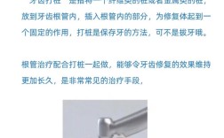 补牙打桩操作方法