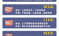 二类二分类 正畸