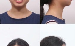 口腔正畸前拍照片