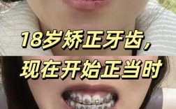 石家庄矫正牙齿去哪儿做？求靠谱医院与专业推荐？