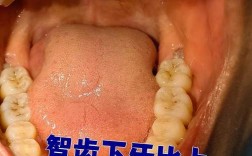 正畸时为啥能发现智齿？检查手段是什么？