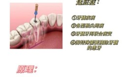 牙齿栓道安装的具体步骤和注意事项有哪些？