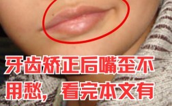 矫正牙齿导致脸歪，是矫正出了问题吗？