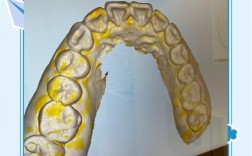 正畸模型测量视频