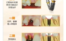 种植前牙的种植方法有哪些？