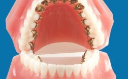 正畸颊面管的长度