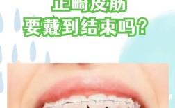 牙齿矫正戴橡皮圈