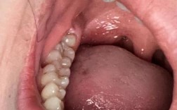 牙齿脱敏土方法真的有效吗？安全要注意啥？