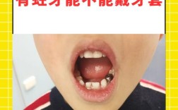 有龋齿还能做牙齿矫正吗？