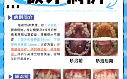 正畸 拔牙 后遗症
