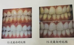 天然牙颜色的测定方法