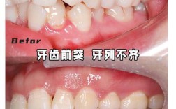 牙齿不严重矫正有必要吗？效果真的好吗？
