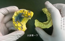 T4K矫正器效果如何？适用哪些情况？