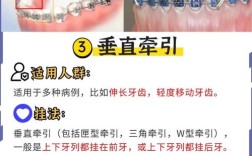 正畸牵引钩弯制方法