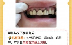 牙龈发黑怎么治？科学有效的治疗方法有哪些？