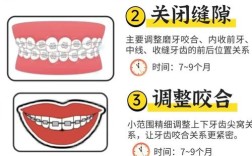 口腔正畸的基本步骤有哪些？详细步骤是怎样的？