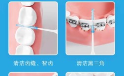 间齿刷的正确使用方法是什么？新手必看的清洁步骤、适用频率及注意事项全解析