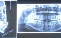 正畸过山车具体指正畸过程中的什么？