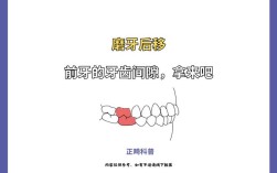 正畸后磨牙移动速度的影响因素有哪些？