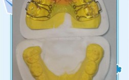 儿童牙齿功能矫正器效果如何？安全吗？