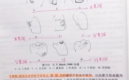 二类洞充填有哪些常用方法？不同充填材料的适用性及操作规范是什么？