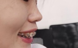 口腔正畸拍照片