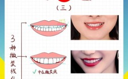 正畸笑线调整，真的要等到最后吗？