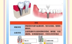 种植牙材料选择需考虑哪些因素？制作工艺有何独特之处？