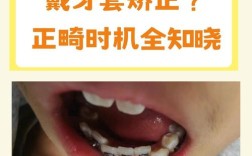 北京幼儿牙齿矫正，早期矫正有必要吗？