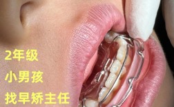 矫正牙齿结束后，效果如何？日常护理要注意啥？