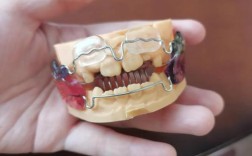 矫正牙齿为何要先戴矫正器？